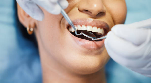 Best Emergency Tooth Extraction in Fairfield Harbour, NC